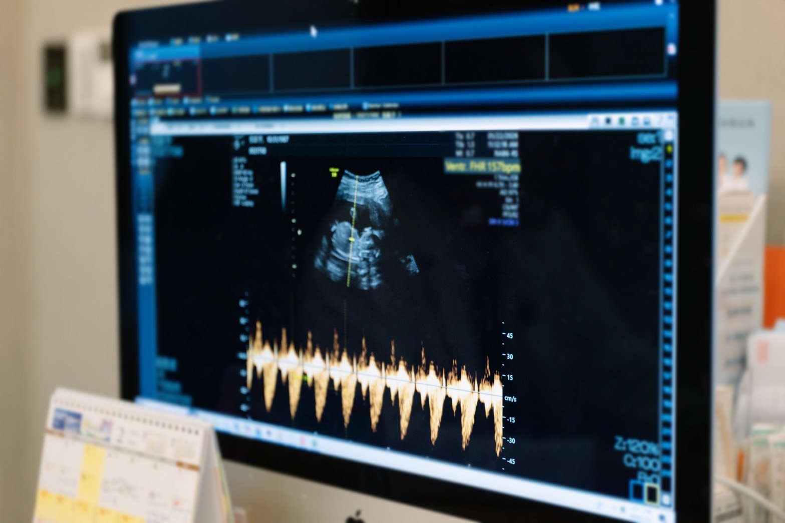 曾啟瑞醫師指出，PGS進行胚胎檢測仍有約20 機率可能存在微小瑕疵，透過多重檢測把關， 0